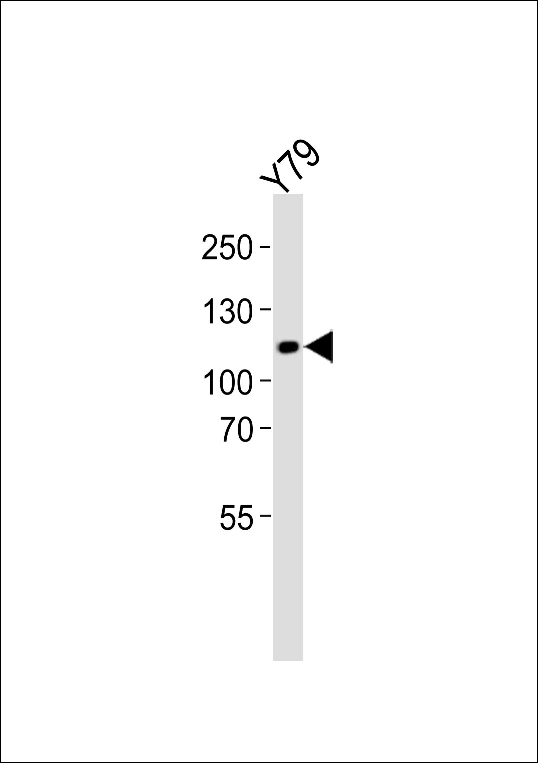 WB - ANKRD24 Antibody (Center) AP20751c